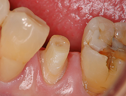 診療案内 | 加須市の歯医者ほそや歯科クリニック-インプラント専門医 